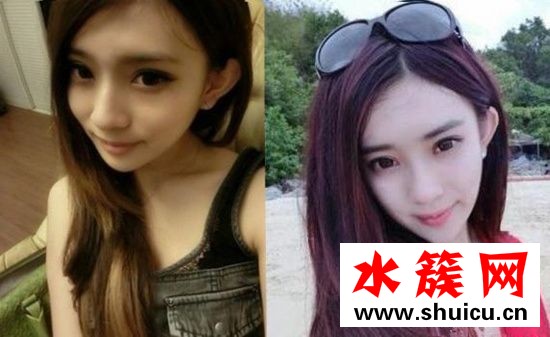 孟子義整容前后照片