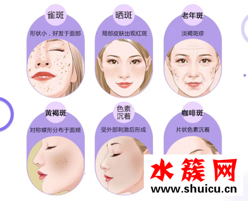 淡斑精華——祛斑霜真的能祛斑嗎