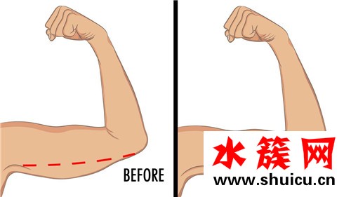 蝴蝶臂是什么樣的 蝴蝶臂怎么形成的 蝴蝶臂是什么樣的