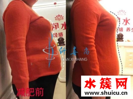 纖喜尚中醫(yī)瘦身風(fēng)靡，都市白領(lǐng)瘦身新風(fēng)尚