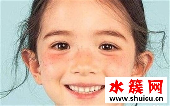 夏天曬斑怎么去除 夏天曬斑到冬天會(huì)沒嗎