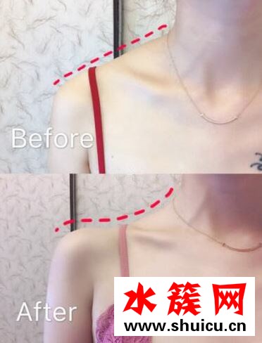 懶人必看去除斜方肌的小動作 矯正溜肩瘦手臂 懶人必看去除斜方肌的小動作: